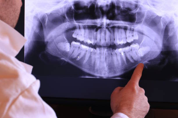 Best Cosmetic Emergency Dentistry in Winston Salem, NC